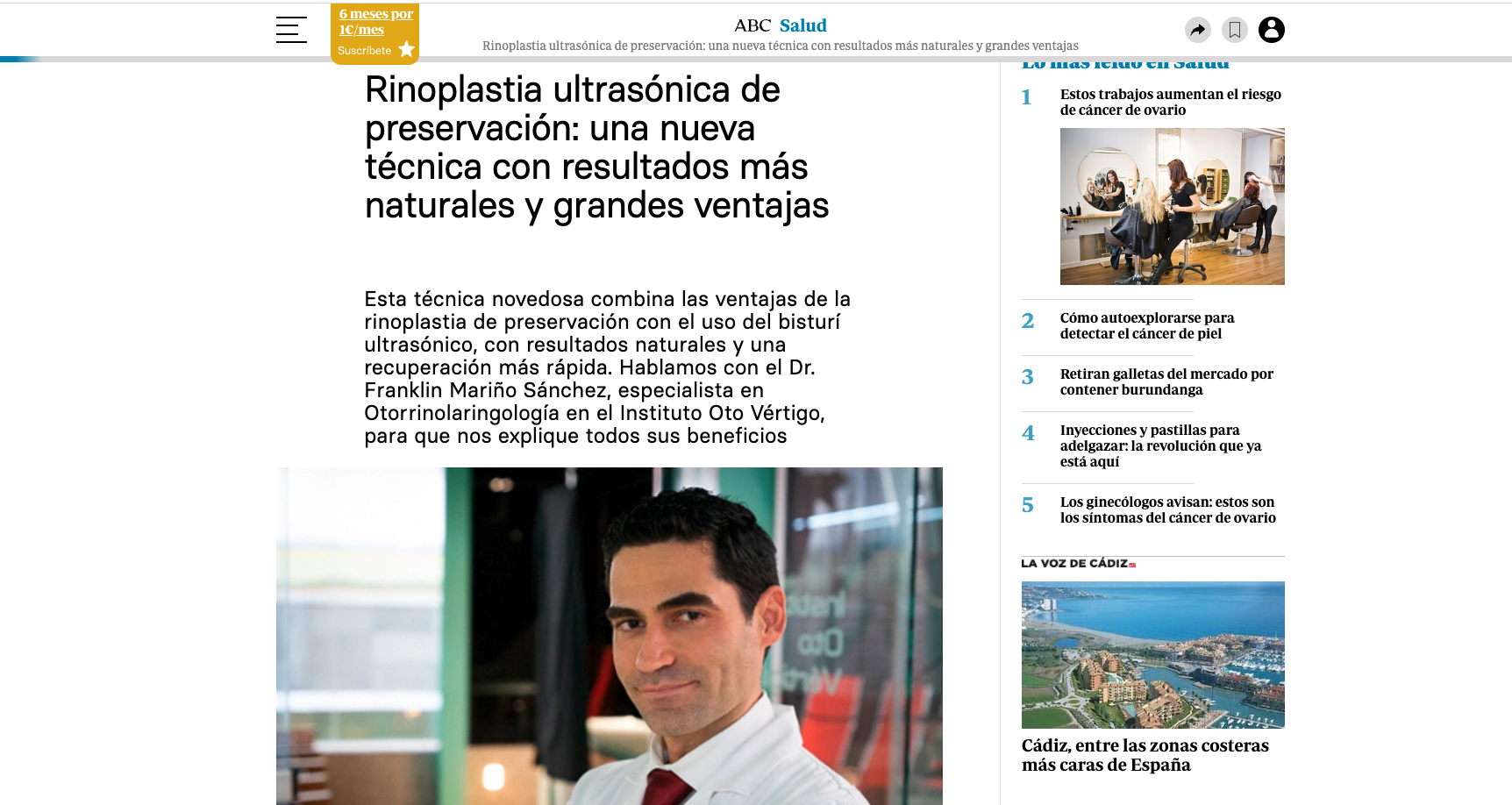 Rinoplastia ultras&oacute;nica de preservaci&oacute;n: una nueva t&eacute;cnica con resultados m&aacute;s naturales y grandes ventajas