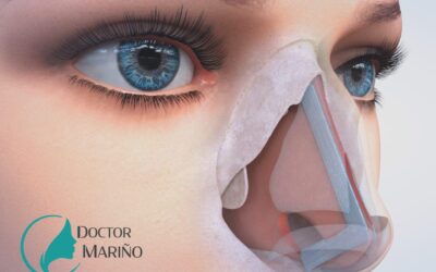 Rinoplastia y Cierre de Perforaci&oacute;n Septal: Recupera tu respiraci&oacute;n y est&eacute;tica en una sola intervenci&oacute;n